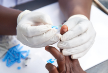Test de dépistage du Vih Sida (©L’Initiative)