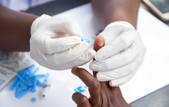 Test de dépistage du Vih Sida (©L’Initiative)